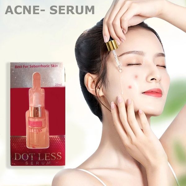 Dot Less Serum Anti Acne